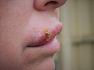 can cigarettes be bought online Canadian teens finding ways to purchase e-cigarettes online